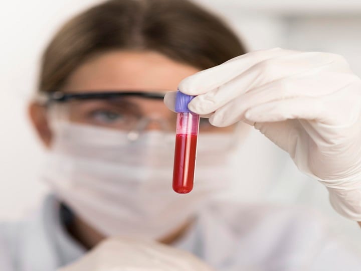 Hematology