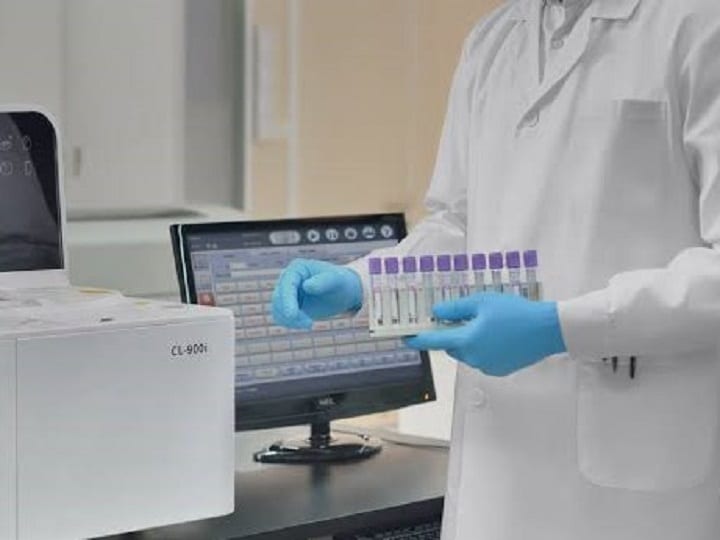 Hormone Analysis