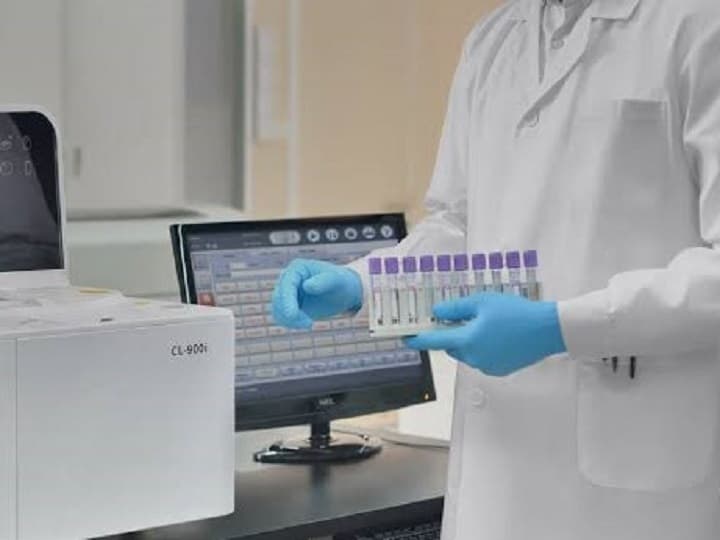 Hormone Analysis